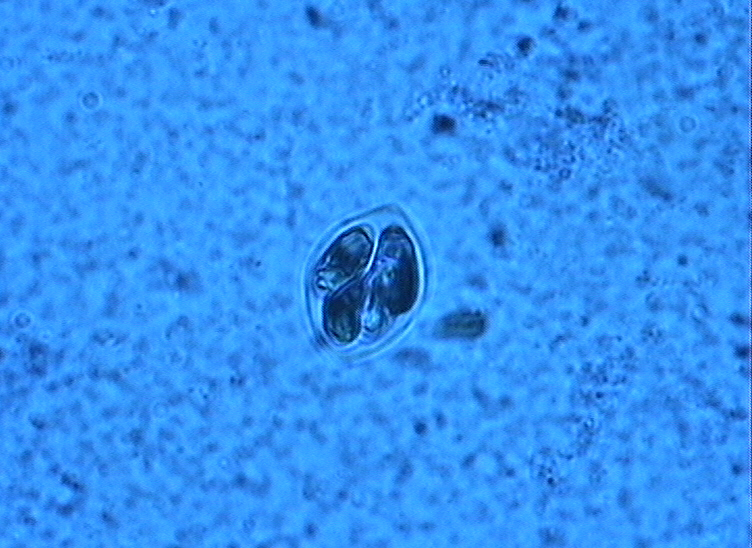 Dictyocha speculum